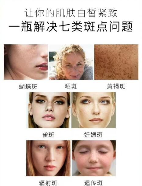 眼下角长斑怎么办?