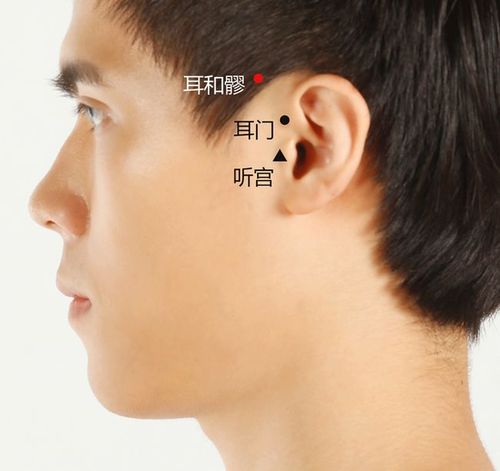 胡有宸艾艾贴穴位图解耳和髎穴