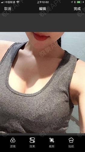 自体脂肪隆胸术后82天_自体脂肪形体雕塑术后82天_隆胸术后82天_自体