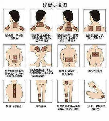 王氏祖传膏药贴除了骨刺和类风湿,其它都是根治的,  肩周炎,腰间盘