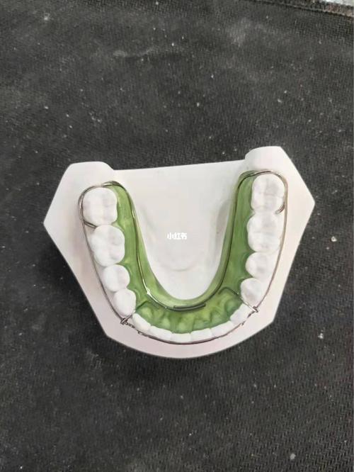 比格保持器!隐形保持器!