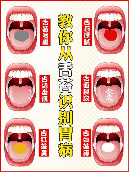 教你从舌苔识别87胃病75简单易懂74超实用75