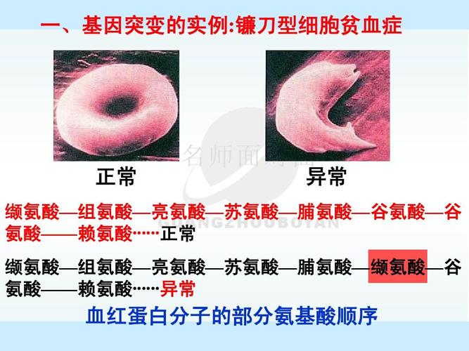 基因突变和基因重组》课件ppt  一,基因突变的实例:镰刀型细胞贫血症