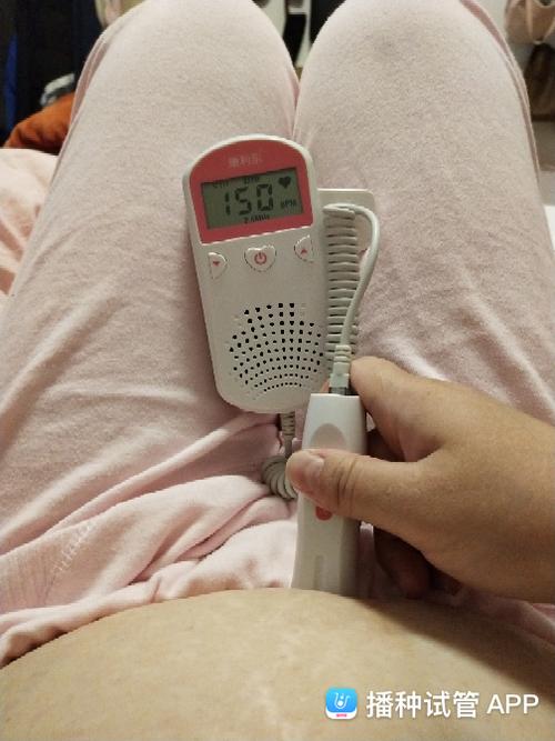 [试管婴儿]胎心监护19周.自己在家也可以