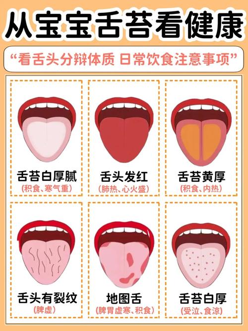 看看宝宝的舌头,如果是这种症状就要留意啦_舌苔_积食