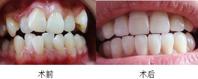 错颌畸形正畸矫正-牙齿矫正-牙齿美容-整形项目报价