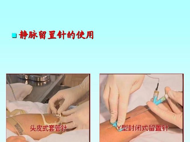 护理学课件——静脉输液与输血ppt