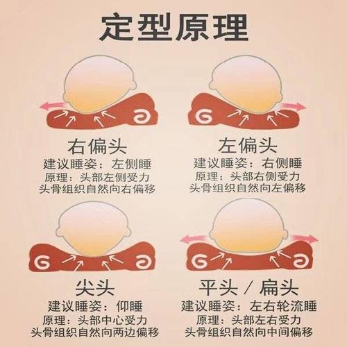 宝宝的头部多久就定型了?这四种头型,要留意了