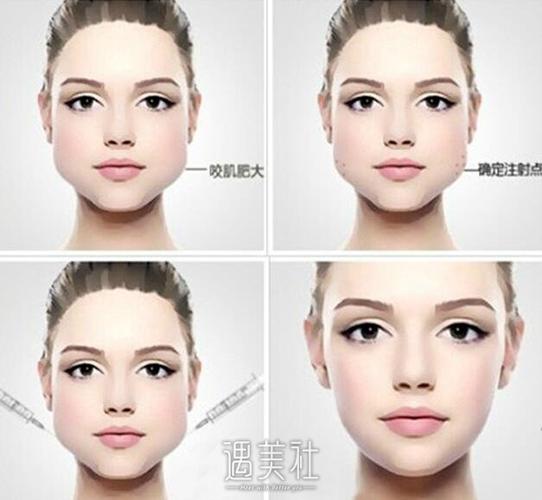 小脸变方脸90的人都是发腮了