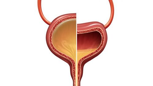 女性尿频,你还在使用抗生素吗?