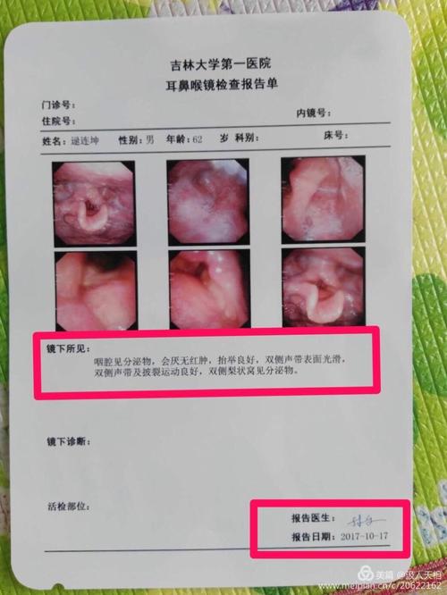 滚蛋吧【扁桃体恶性肿瘤】