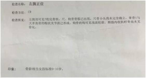 孩子性早熟当心长不高