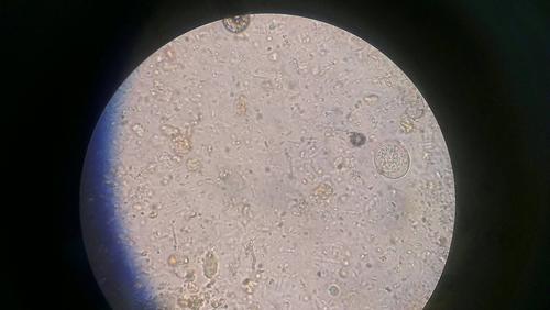 这是不是虫卵啊