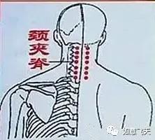 肩周炎,颈椎炎,头疼 【取穴】患者俯伏或俯卧位,当脊柱棘突间两侧,后