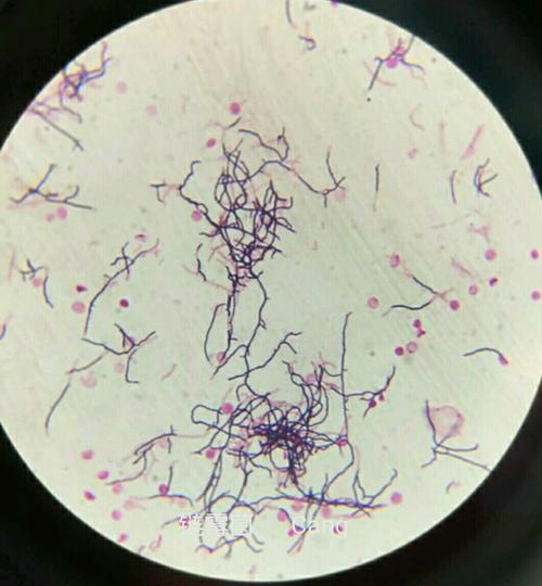 真菌大讲堂拾零 少见细菌及寄生虫,细胞