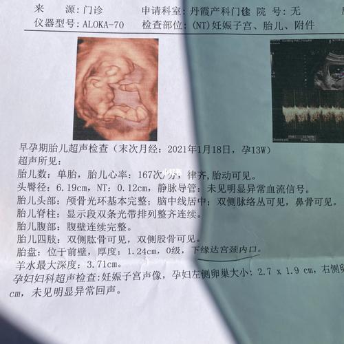 12-13周宝宝nt四维可以看男女了吗_nt检查_四维彩超_金牛座_金牛宝宝