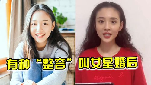 有种整容叫女星结婚后吴倩分开滤镜原形毕露赵丽颖一目了然