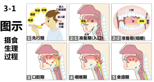 吞咽障害老人患者の喂饭策略