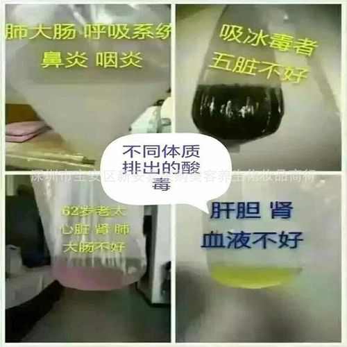 工厂直销;沙棘能量油沙棘膏排湿排寒排酸通经络暖莹排酸膏