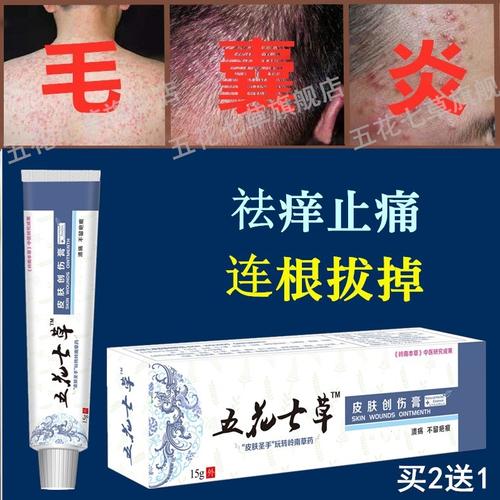 治毛囊炎药膏私处脸部背部痘痘脓包型痤疮头皮痒溢脂