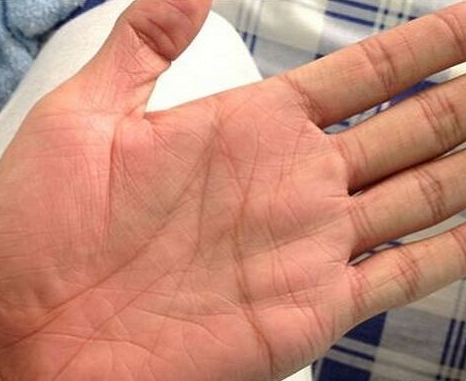 手相金星丘横纹,事业操劳,受婚姻影响,事业发展缓慢.