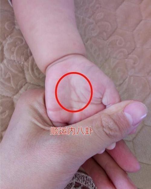 孩子长时间积食成"疳积",归根父母不够重视,医生:太愚昧了