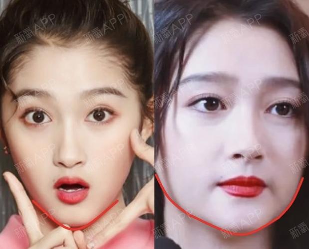 国名闺女关晓彤才24岁,怎么也发腮了?