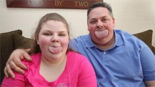 世界上最宽的舌头有多宽? 比苹果6plus还宽