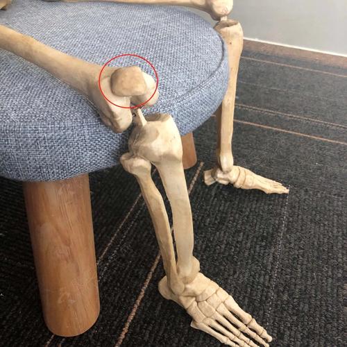 你的膝盖咔咔响,你保护好它了吗?