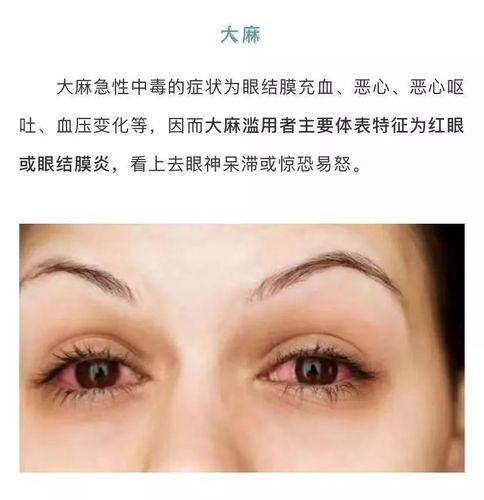 往往是给他人的第一印象 而吸毒者的眼睛  也会有一些不一样的特征