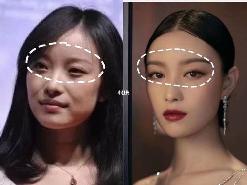 明星级别抗衰老鼻子—印堂—眉骨_抗衰老_眉骨_美妆