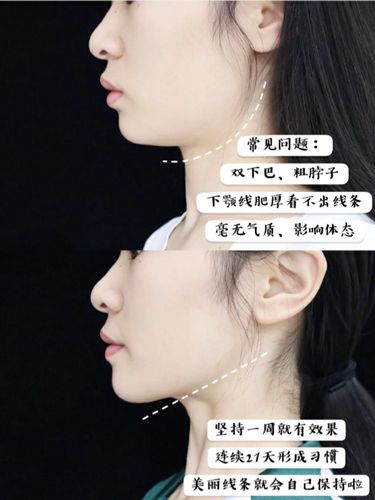 下颚线养成记瘦脸瘦双下巴