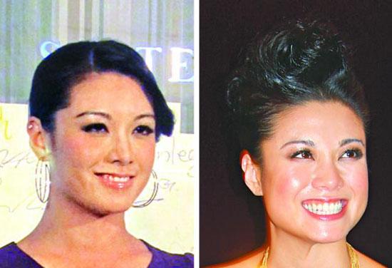 廖碧儿大腮骨消失变刀削脸 惹整容疑云(图)