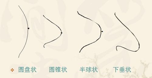 乳房有几种型状