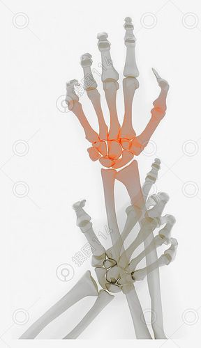 手部骨骼x光