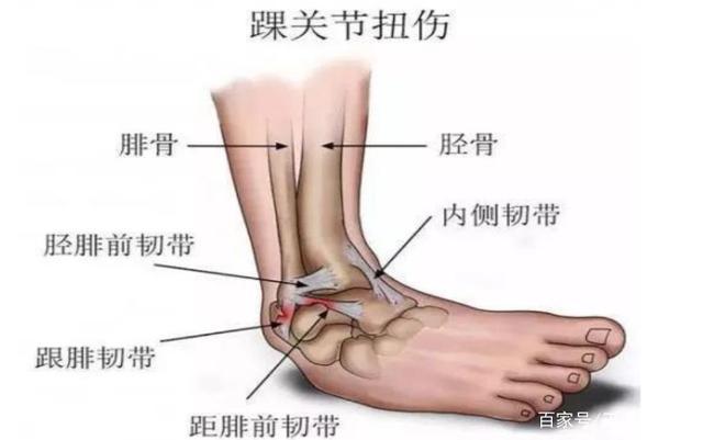 脚崴了该怎么办?医生说:崴脚不可忽视,教你4招处理崴伤!