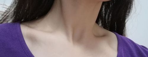 锁骨拍照