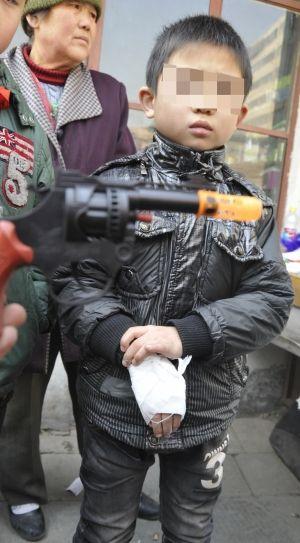 1元"火炮枪" 炸伤8岁男童右手(图)