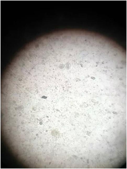 (显微镜下球虫卵囊)