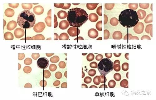 患教课堂◆看懂血常规之血液三兄弟之白细胞
