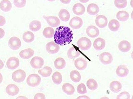 55成熟嗜碱性粒细胞