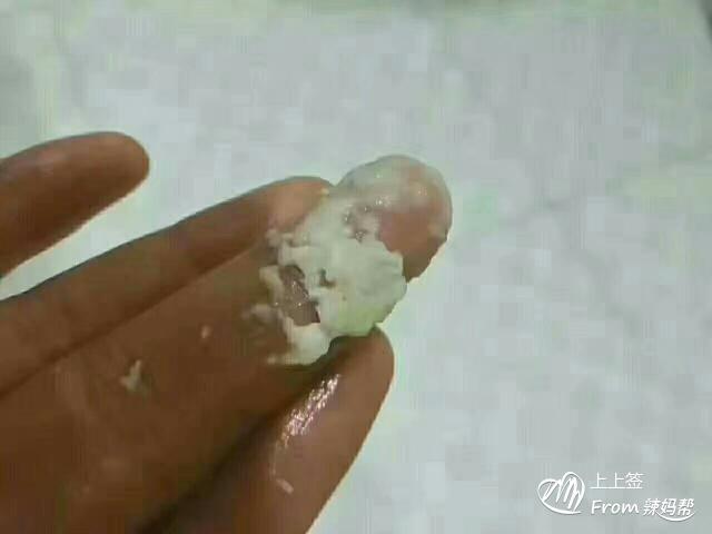 被吓到了 br/>这样的豆腐渣 br/>霉菌性阴道炎 br/>你是多痒 br/>我