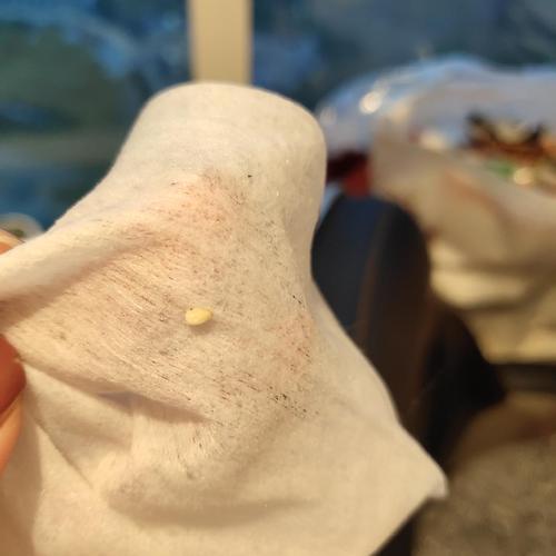 请问这个是绦虫节片吗?