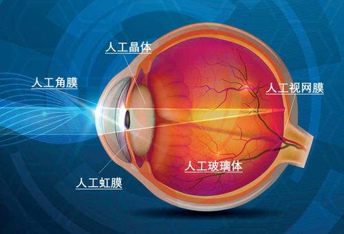 科研前线:人工视网膜组装的ec-eye仿生眼