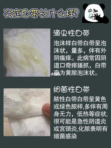 用了凝胶居然排出这么多脏东西?也太吓人了_凝胶_妇科
