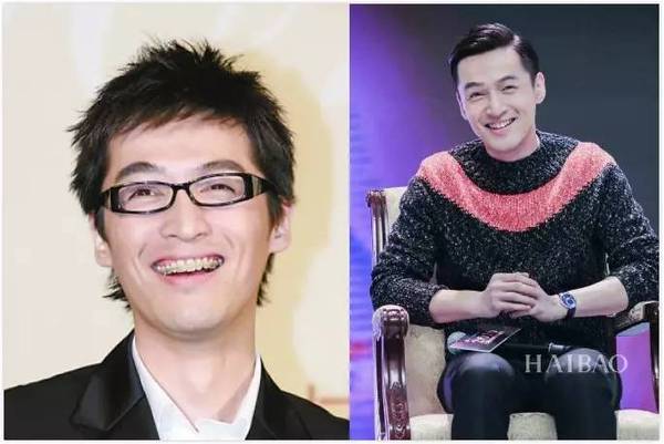 爱美从来不只是女icon的权利,胡歌之前也是一位牙套小哥.