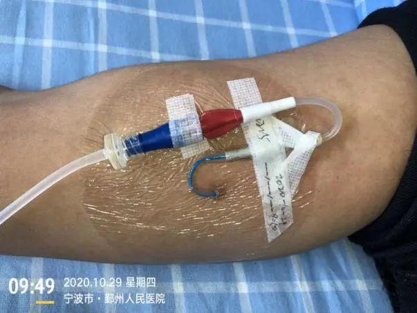 注意:这样固定picc危机四伏? 转发提醒所有人|导管