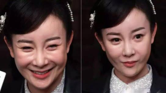 张檬实际上李小璐的颧骨变得比较高,因此她笑起来的时候,颧骨太突出了