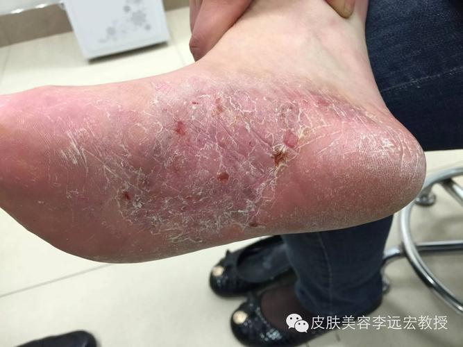 【搞笑】爸爸跟妈妈有什么区别?泰州人的答案真是太完美了!