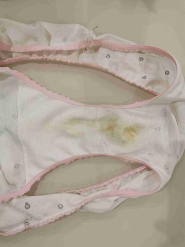 不知道白带这个算不算正常